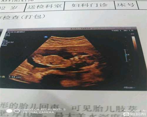 武汉找捐卵代孕机构_武汉2020年代孕包成功多少钱_武汉代孕费用包男孩包成功